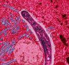 Plasmodium (Malaria Protozoa)
